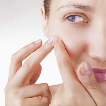 How Do Acne Stickers Actually Work?