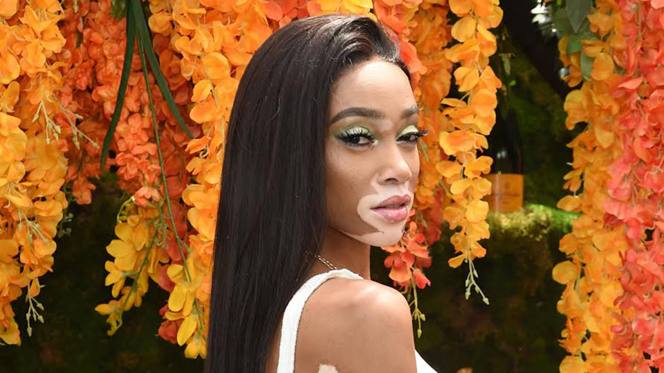 Winnie Harlow