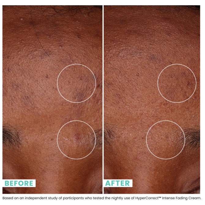 urban skin rx dark spots