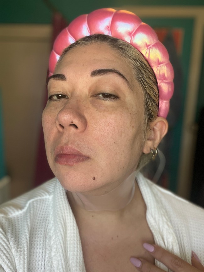 Marie Lodi in SiO Necklift